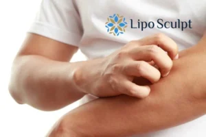 Best Actinic Keratoses Removal 4 prevent your actinic keratoses Sandwich getting worse - call our team today!