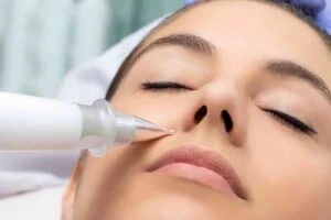 Best Actinic Keratoses Removal 3 Actinic keratoses Sandwich solutions - book in today!