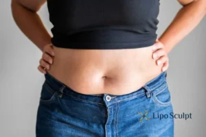 Bidding Farewell to Muffin Tops with Aqualyx Fat Injections 2 Do you wish you could reduce your muffin top Sandwich With Aqualy fat dissolving injections you can!